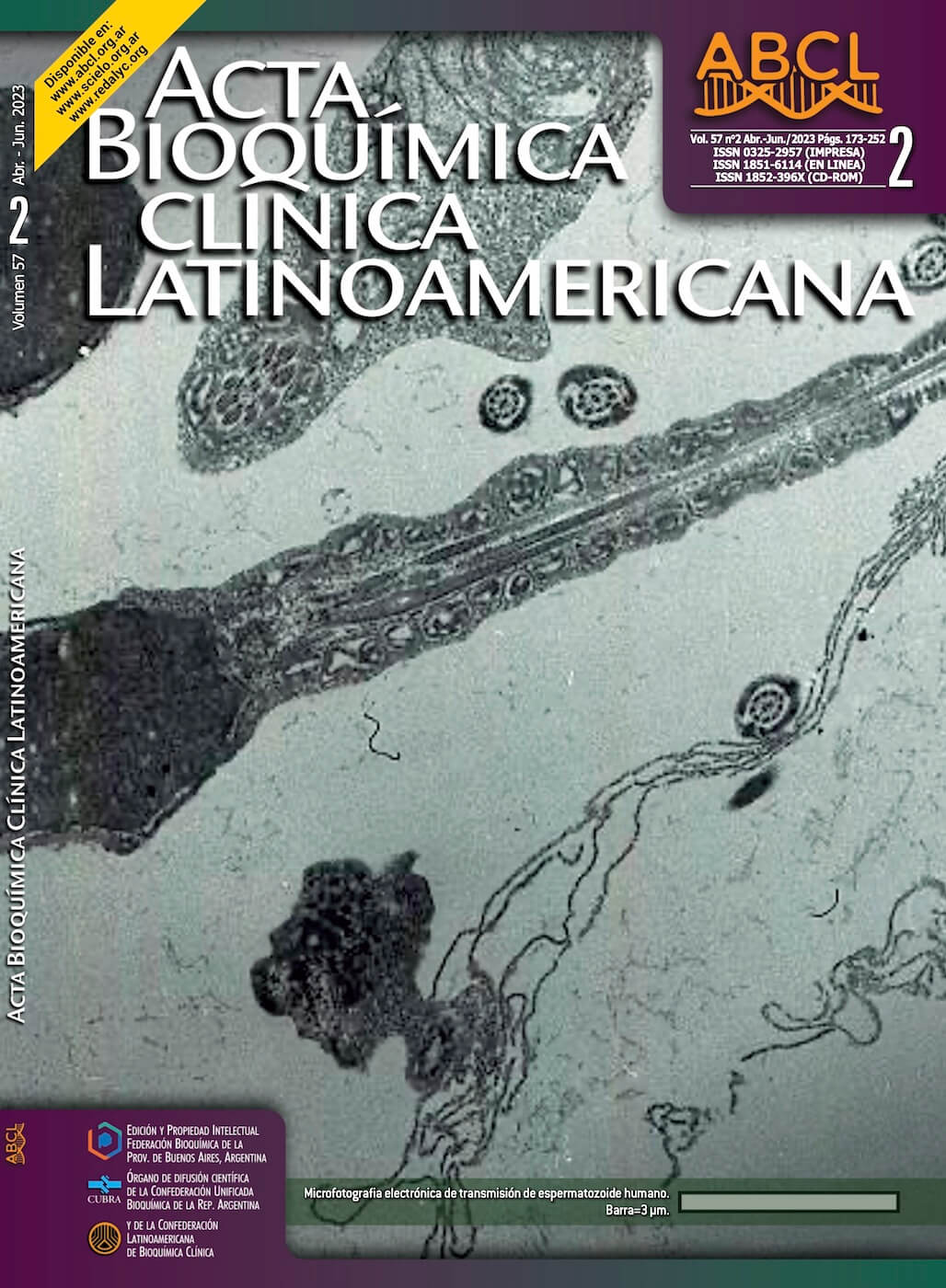 Revista ABCL Vol. 57 N°2 Abril – Junio 2023